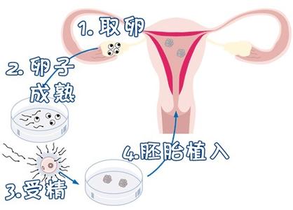 国内供卵代孕服务